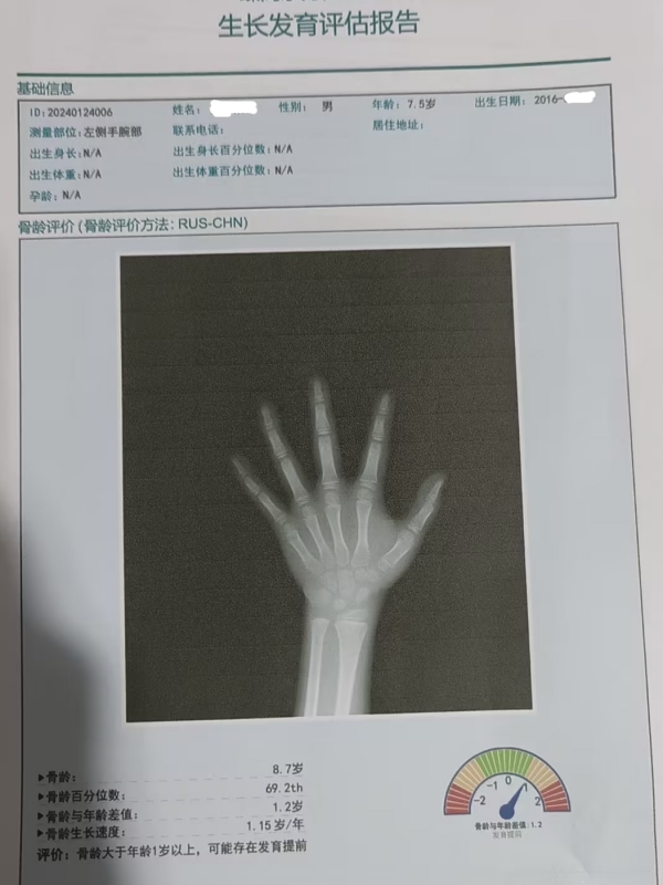 骨齡和身高有什么關(guān)系？每個(gè)孩子都有必要檢測(cè)嗎？